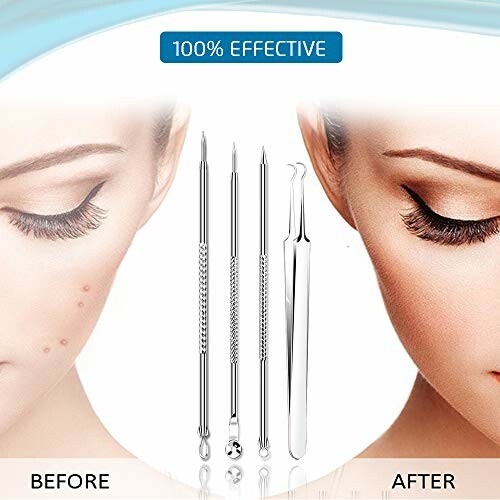 Blemish removal tools with before and after skin comparison.